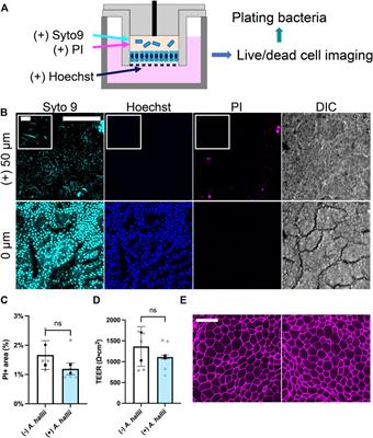 A Platform for Co-Culture of Primary Human Colonic Epithelium With Anaerobic Probiotic Bacteria